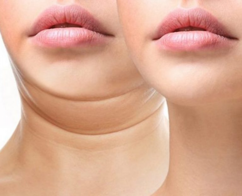 tiem-tan-mo-nong-cam